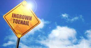 ingrown toenails