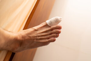 picture of a foot with the big toe wrapped up after ingrown toe nail treatment