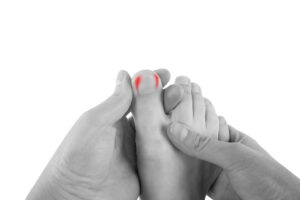 black and white picture of person holding big toe with red pain points on each side of the toe