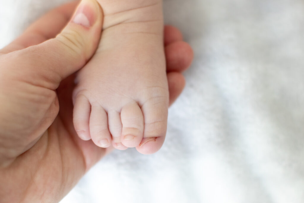 ingrown baby toe nail. A woman is holding her baby's foot.